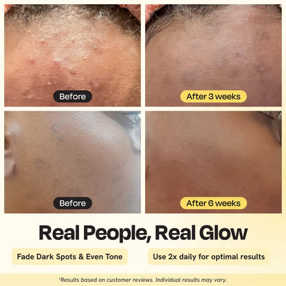 Advanced Brightening Moisturizer